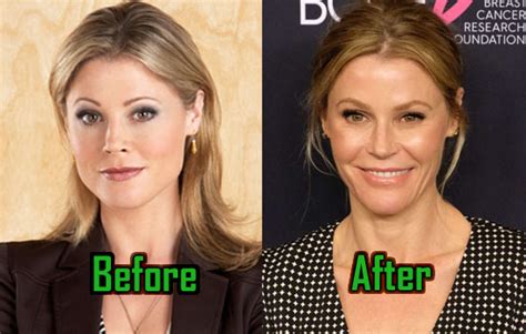 julie bowen boobs|Modern Family star Julie Bowen publicly reveals plastic surgery